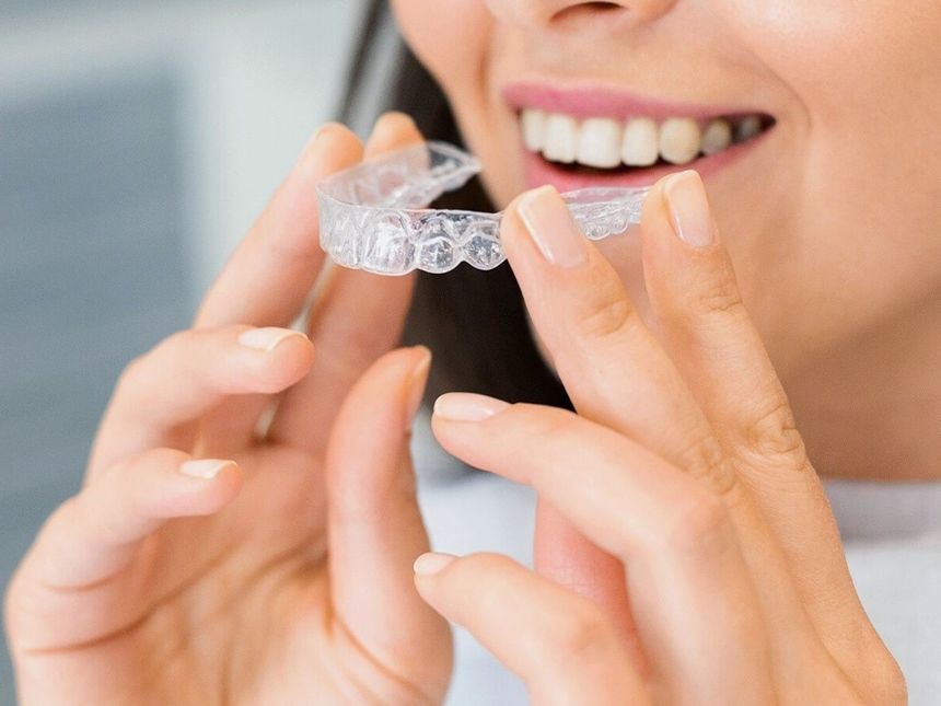Alinhador invisível transparente sendo posicionado, mostrando como é discreto