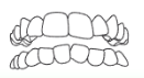 Dentes apinhados