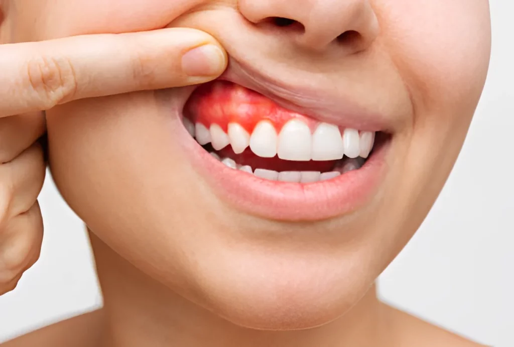 periodontia joinville centro